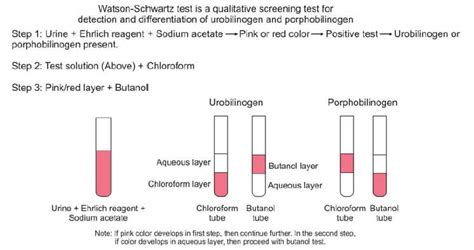 watson schwartz test|watson schwartz urine test.